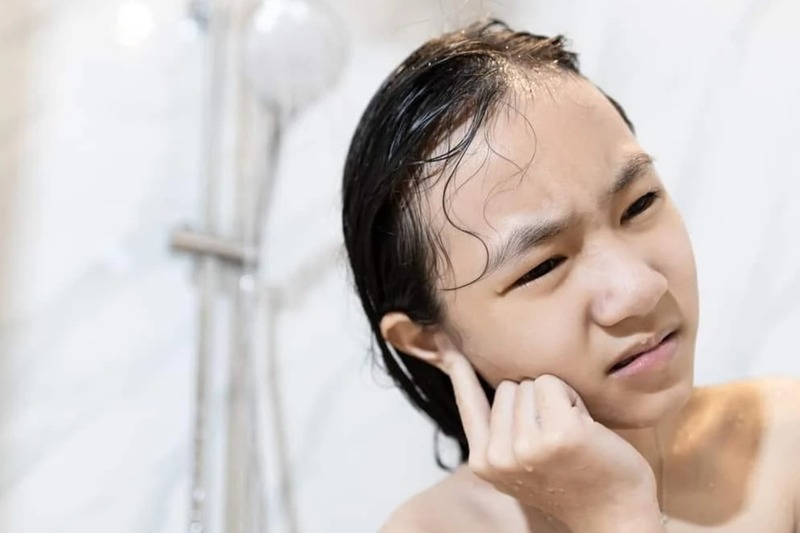 Khi nước vào tai gây ù, cần xử lý nhẹ nhàng bằng cách nghiêng đầu, lau khô tai ngoài và tránh ngoáy tai sâu. 